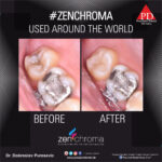 ZENCHROMA - Universal Composite - Image 2