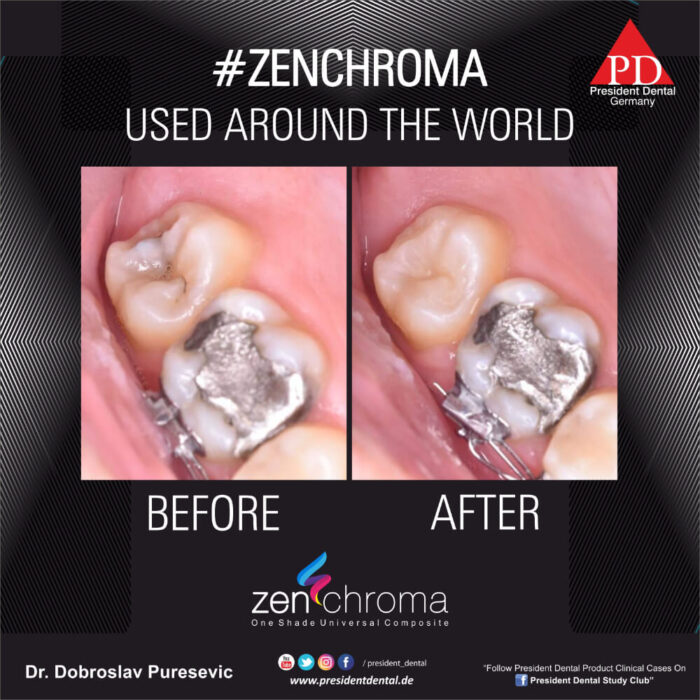 ZENCHROMA - Universal Composite - Image 3