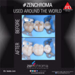 ZENCHROMA - Universal Composite - Image 4