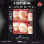 ZENCHROMA - Universal Composite - Image 5