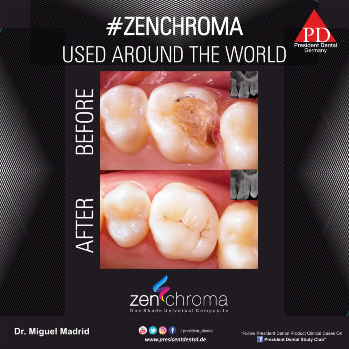 ZENCHROMA - Universal Composite - Image 6