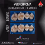 ZENCHROMA - Universal Composite - Image 7