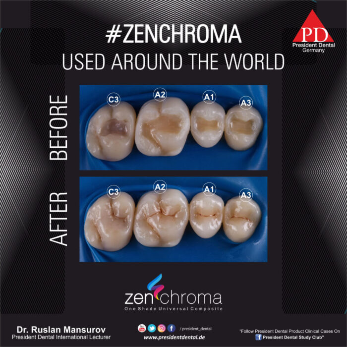 ZENCHROMA - Universal Composite - Image 8