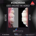 ZENCHROMA - Universal Composite - Image 8