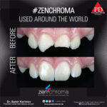 ZENCHROMA - Universal Composite - Image 9