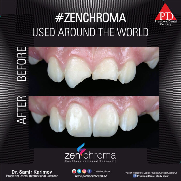 ZENCHROMA - Universal Composite - Image 10