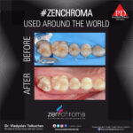 ZENCHROMA - Universal Composite - Image 10