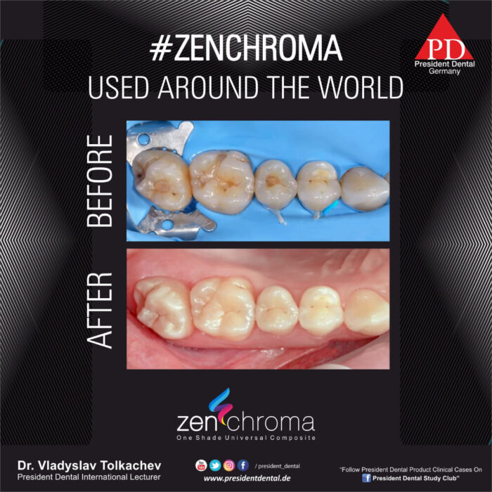 ZENCHROMA - Universal Composite - Image 11